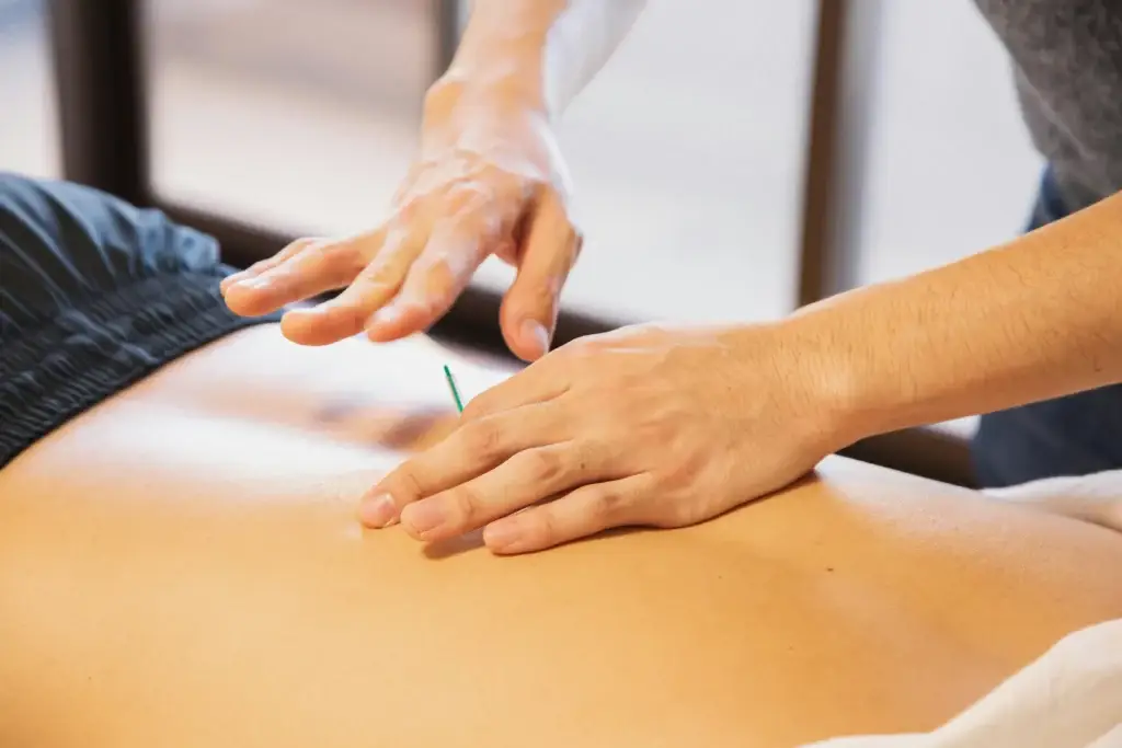 Acupuncture treatment at the Limitless clinic