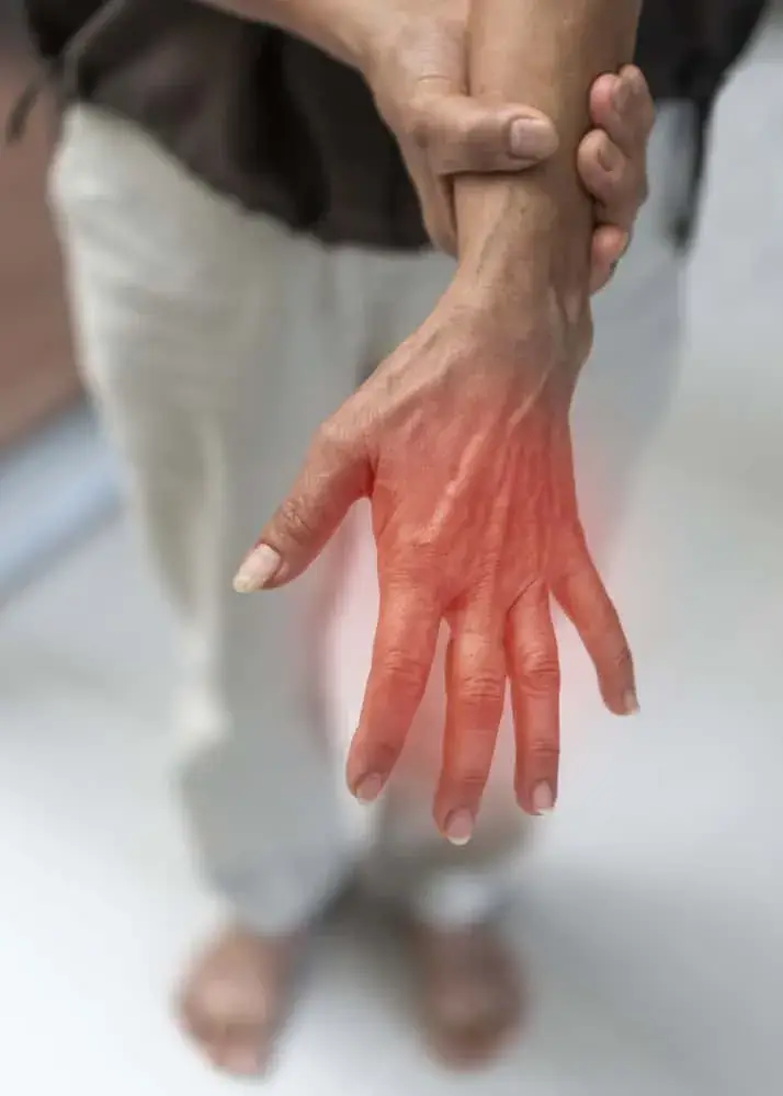 Chronic nerve pain from years of commuting.